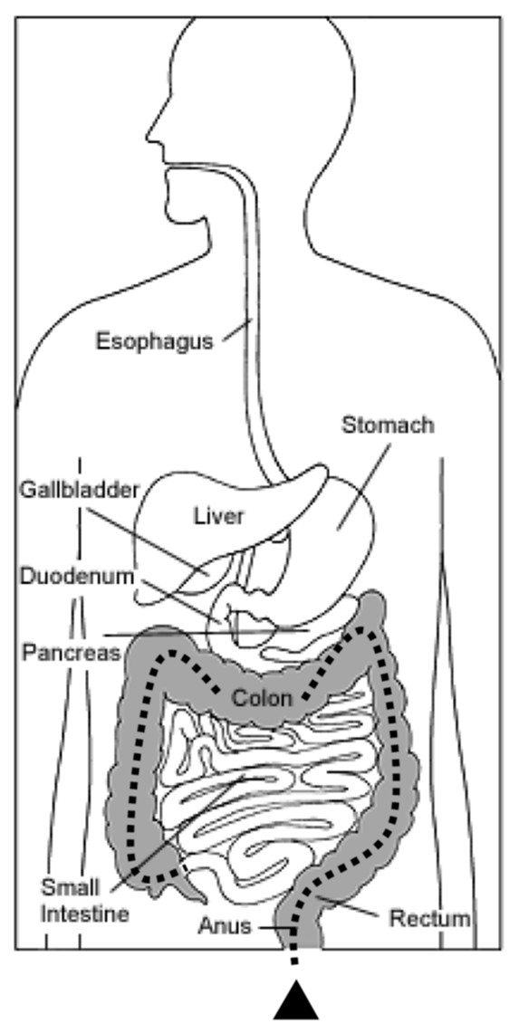 Picture1